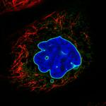 Emerin Antibody in Immunocytochemistry (ICC/IF)