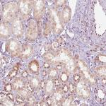 Emerin Antibody in Immunohistochemistry (Paraffin) (IHC (P))
