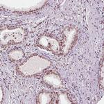 Emerin Antibody in Immunohistochemistry (Paraffin) (IHC (P))
