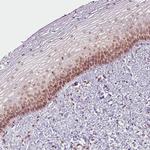 Emerin Antibody in Immunohistochemistry (Paraffin) (IHC (P))