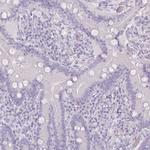SLC27A5 Antibody in Immunohistochemistry (Paraffin) (IHC (P))