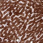 SLC27A5 Antibody in Immunohistochemistry (Paraffin) (IHC (P))