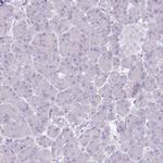 SLC27A5 Antibody in Immunohistochemistry (Paraffin) (IHC (P))