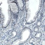 SLC27A5 Antibody in Immunohistochemistry (Paraffin) (IHC (P))