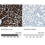 SLC27A5 Monoclonal Antibody (CL0215)