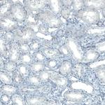 SLC27A5 Antibody in Immunohistochemistry (Paraffin) (IHC (P))