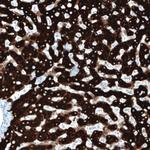 SLC27A5 Antibody in Immunohistochemistry (Paraffin) (IHC (P))