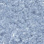 SLC27A5 Antibody in Immunohistochemistry (Paraffin) (IHC (P))