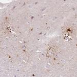 FABP7 Antibody in Immunohistochemistry (Paraffin) (IHC (P))