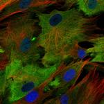 S100A4 Monoclonal Antibody (CL0239)