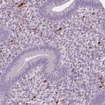 S100A4 Antibody in Immunohistochemistry (Paraffin) (IHC (P))