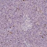 S100A4 Antibody in Immunohistochemistry (Paraffin) (IHC (P))