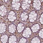 S100A4 Antibody in Immunohistochemistry (Paraffin) (IHC (P))