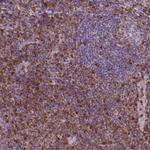 S100A4 Antibody in Immunohistochemistry (Paraffin) (IHC (P))