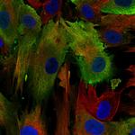 S100A4 Monoclonal Antibody (CL0240)