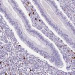 S100A4 Antibody in Immunohistochemistry (Paraffin) (IHC (P))