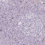 S100A4 Antibody in Immunohistochemistry (Paraffin) (IHC (P))