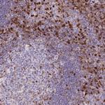 S100A4 Antibody in Immunohistochemistry (Paraffin) (IHC (P))