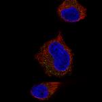 STX7 Antibody in Immunocytochemistry (ICC/IF)