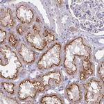 STX7 Antibody in Immunohistochemistry (Paraffin) (IHC (P))