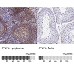 STX7 Antibody in Immunohistochemistry (Paraffin) (IHC (P))