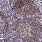 STX7 Antibody in Immunohistochemistry (Paraffin) (IHC (P))