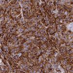 STX7 Antibody in Immunohistochemistry (Paraffin) (IHC (P))