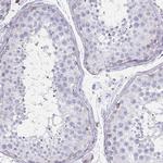 STX7 Antibody in Immunohistochemistry (Paraffin) (IHC (P))