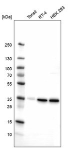 STX7 Antibody in Western Blot (WB)