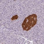 SCGN Antibody in Immunohistochemistry (Paraffin) (IHC (P))