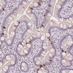 SCGN Antibody in Immunohistochemistry (Paraffin) (IHC (P))
