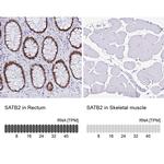 SATB2 Antibody