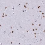 SATB2 Antibody in Immunohistochemistry (Paraffin) (IHC (P))