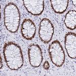 SATB2 Antibody in Immunohistochemistry (Paraffin) (IHC (P))