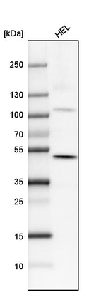 SATB2 Antibody in Western Blot (WB)