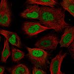 RBM3 Monoclonal Antibody (CL0296)