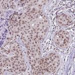 RBM3 Antibody in Immunohistochemistry (Paraffin) (IHC (P))