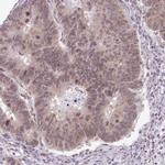 RBM3 Antibody in Immunohistochemistry (Paraffin) (IHC (P))