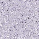 RBM3 Antibody in Immunohistochemistry (Paraffin) (IHC (P))