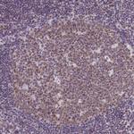 RBM3 Antibody in Immunohistochemistry (Paraffin) (IHC (P))