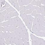 Anillin Antibody in Immunohistochemistry (Paraffin) (IHC (P))