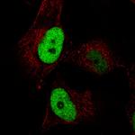 Anillin Antibody in Immunocytochemistry (ICC/IF)