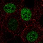 Anillin Antibody in Immunocytochemistry (ICC/IF)