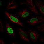 Anillin Antibody in Immunocytochemistry (ICC/IF)