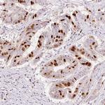 Anillin Antibody in Immunohistochemistry (Paraffin) (IHC (P))