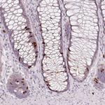 Anillin Antibody in Immunohistochemistry (Paraffin) (IHC (P))