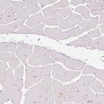 Anillin Antibody in Immunohistochemistry (Paraffin) (IHC (P))