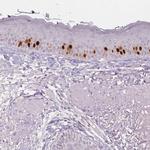 Anillin Antibody in Immunohistochemistry (Paraffin) (IHC (P))