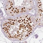 Anillin Antibody in Immunohistochemistry (Paraffin) (IHC (P))