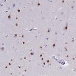 SATB2 Antibody in Immunohistochemistry (Paraffin) (IHC (P))